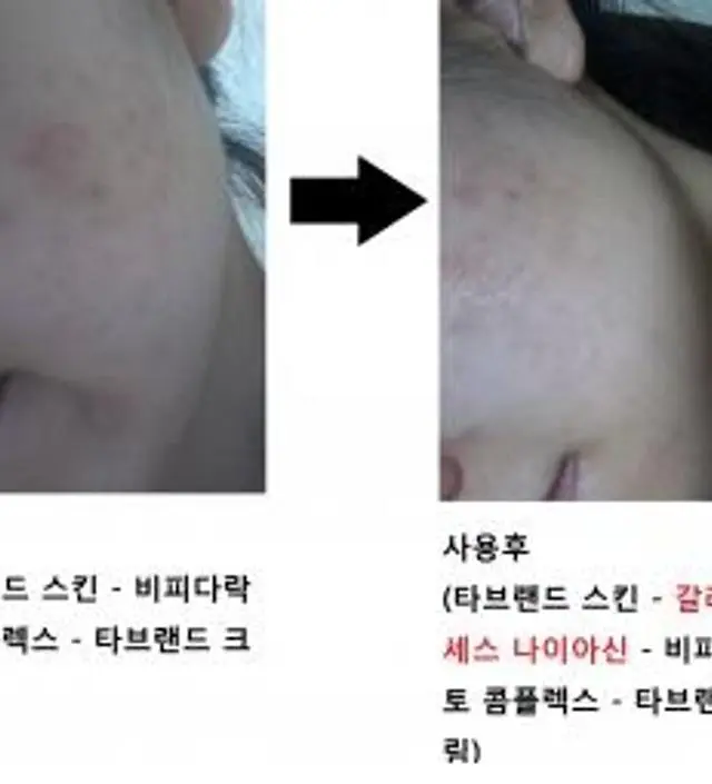갈락토미 나이아신 에센스 50ml
