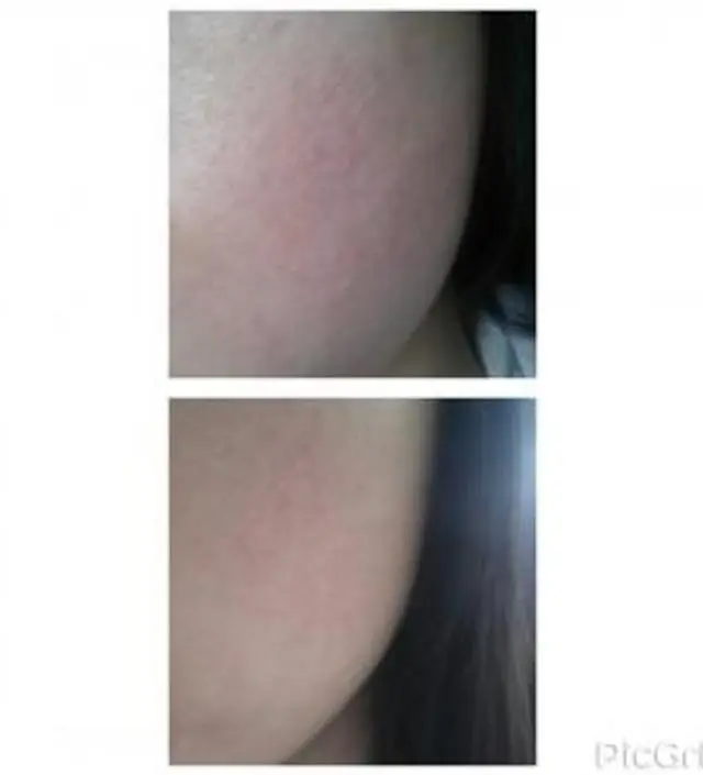 갈락토미 나이아신 에센스 50ml
