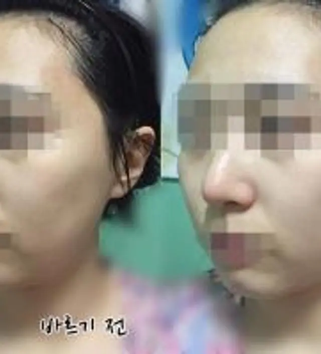 갈락토미 나이아신 에센스 50ml
