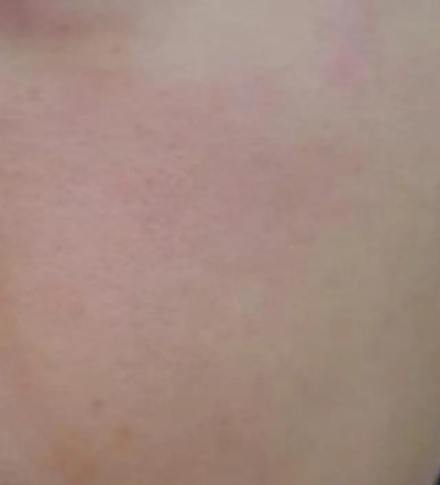 갈락토미 나이아신 에센스 50ml
