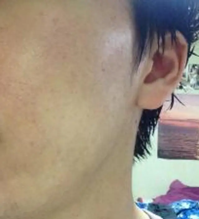 갈락토미 나이아신 에센스 50ml
