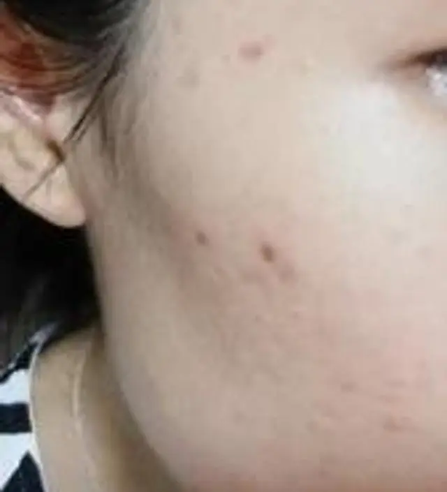 갈락토미 나이아신 에센스 50ml
