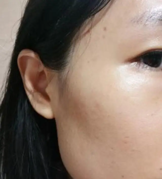 갈락토미 나이아신 에센스 50ml
