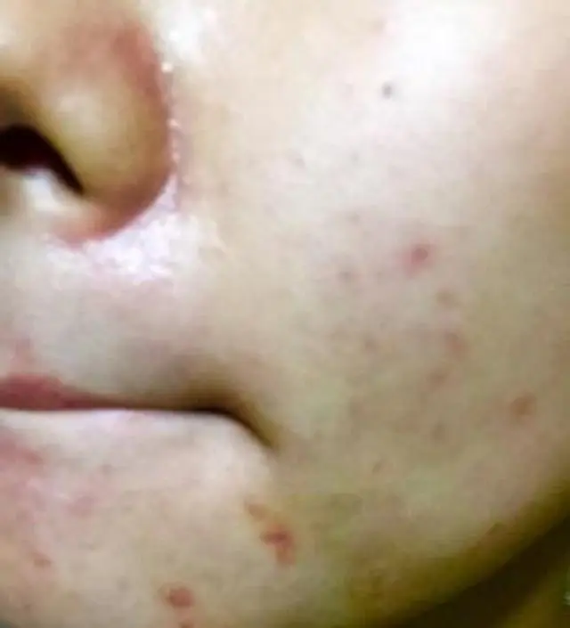 갈락토미 나이아신 에센스 50ml
