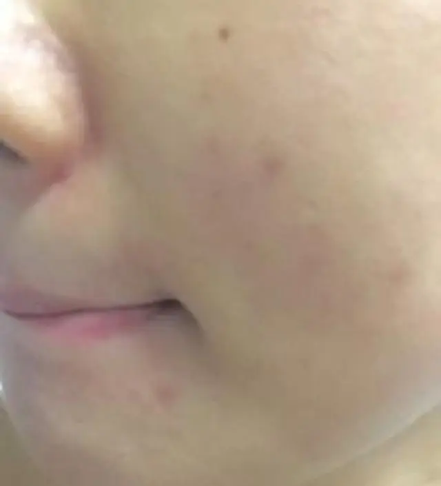 갈락토미 나이아신 에센스 50ml
