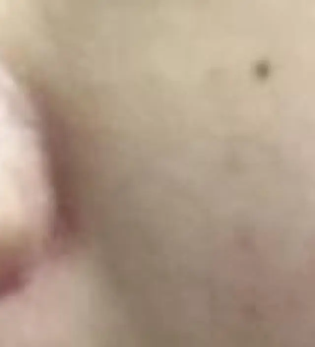 갈락토미 나이아신 에센스 50ml
