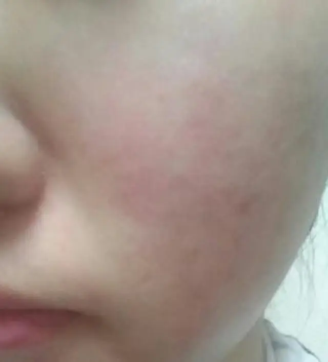 갈락토미 나이아신 에센스 50ml
