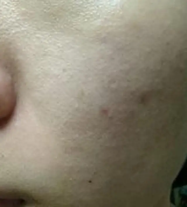 갈락토미 나이아신 에센스 50ml
