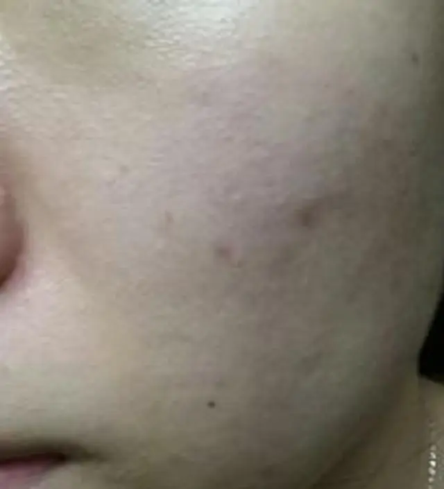 갈락토미 나이아신 에센스 50ml
