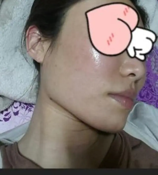 갈락토미 나이아신 에센스 50ml
