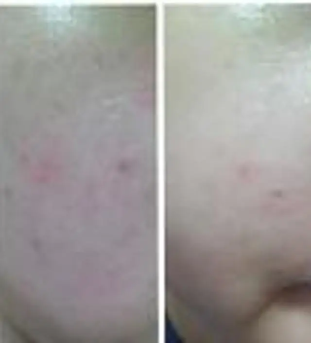 갈락토미 나이아신 에센스 50ml
