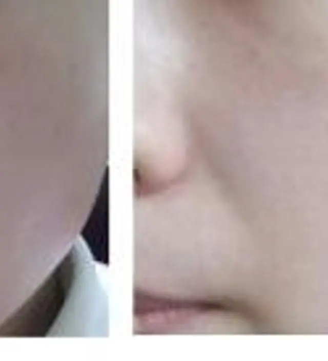 갈락토미 나이아신 에센스 50ml
