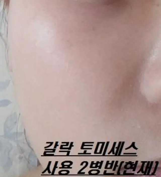 갈락토미 나이아신 에센스 50ml
