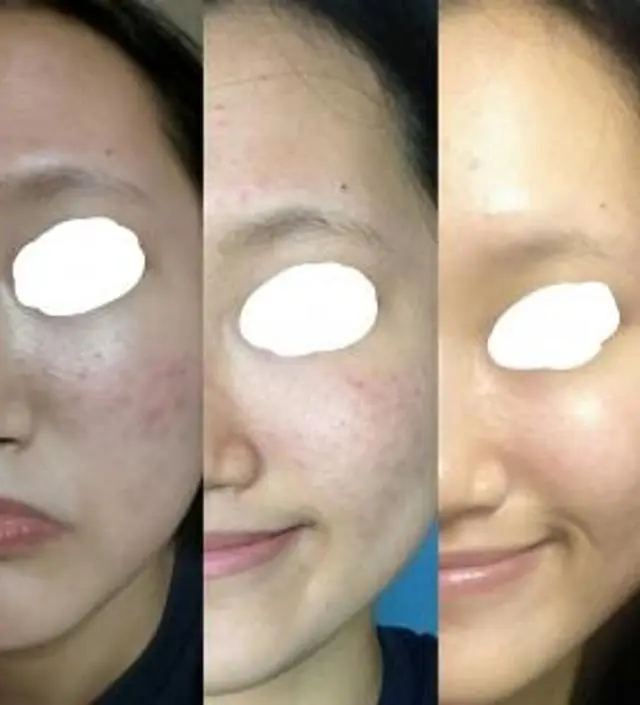 갈락토미 나이아신 에센스 50ml
