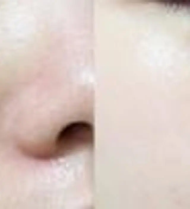 갈락토미 나이아신 에센스 50ml
