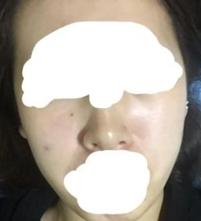 갈락토미 나이아신 에센스 50ml
