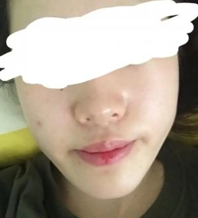 갈락토미 나이아신 에센스 50ml
