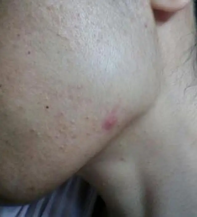 갈락토미 나이아신 에센스 50ml
