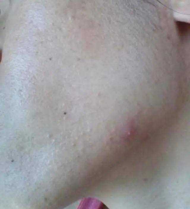 갈락토미 나이아신 에센스 50ml
