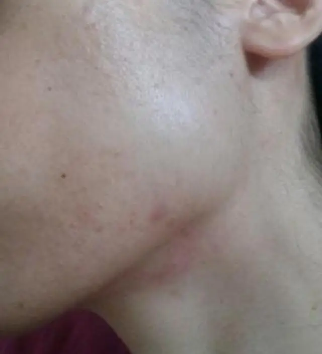 갈락토미 나이아신 에센스 50ml
