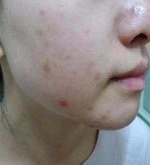 갈락토미 나이아신 에센스 50ml
