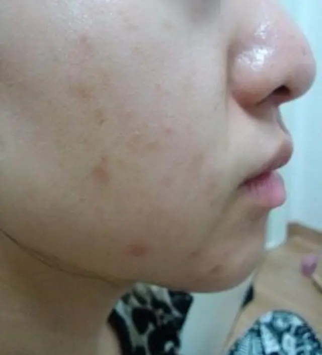 갈락토미 나이아신 에센스 50ml
