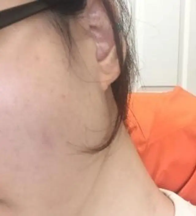 갈락토미 나이아신 에센스 50ml
