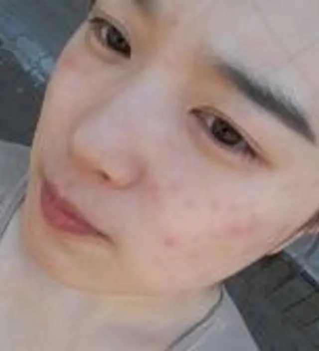 갈락토미 나이아신 에센스 50ml
