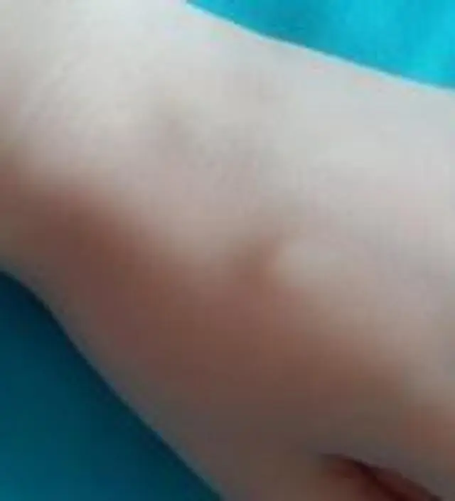 갈락토미 나이아신 에센스 50ml
