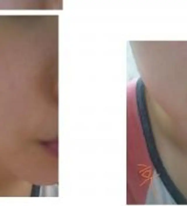 갈락토미 나이아신 에센스 50ml
