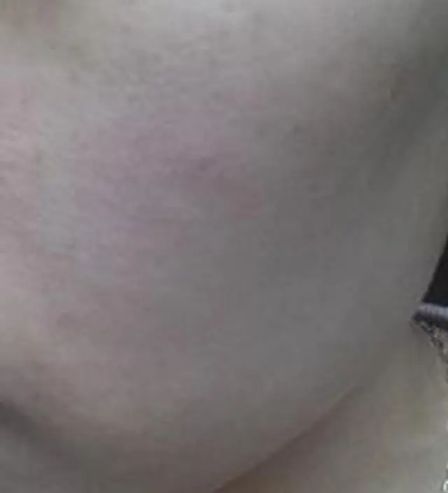 갈락토미 나이아신 에센스 50ml
