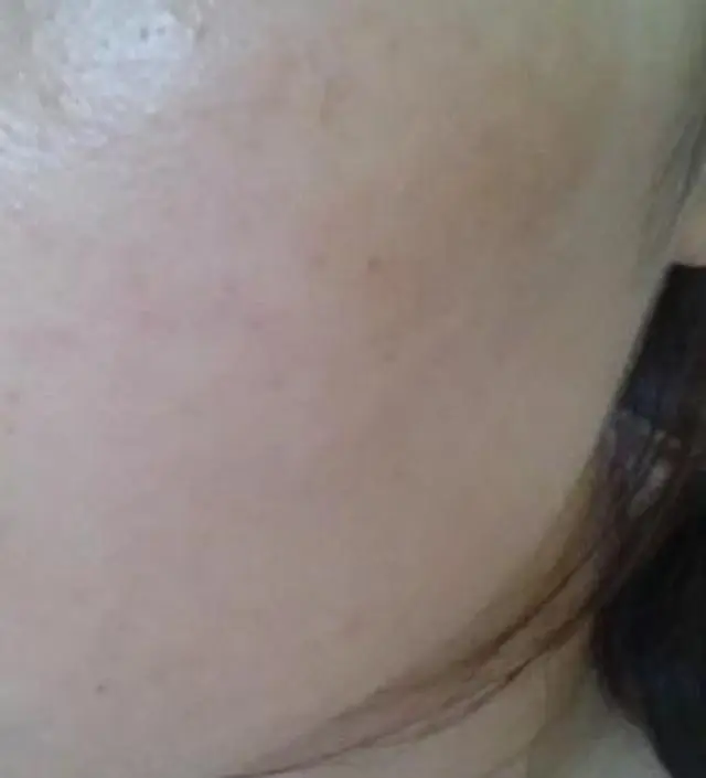 갈락토미 나이아신 에센스 50ml
