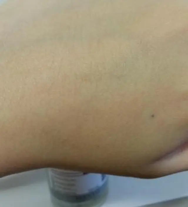 갈락토미 나이아신 에센스 50ml
