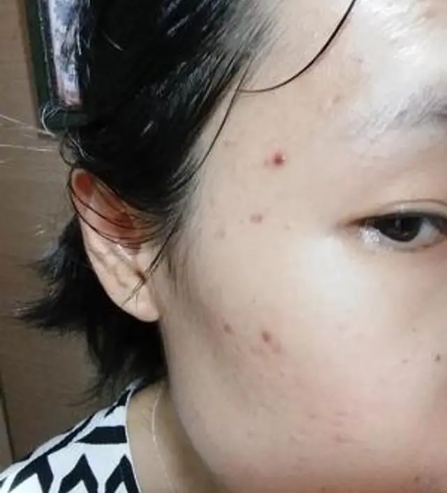 갈락토미 나이아신 에센스 50ml
