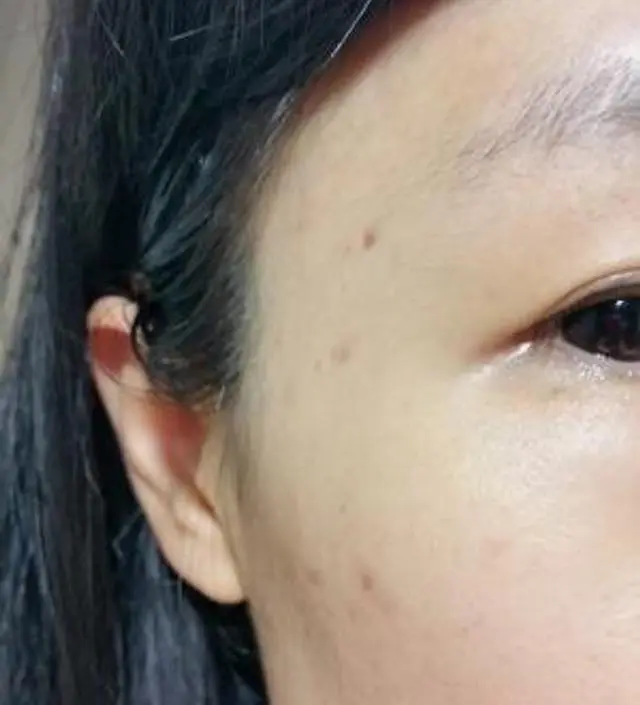 갈락토미 나이아신 에센스 50ml
