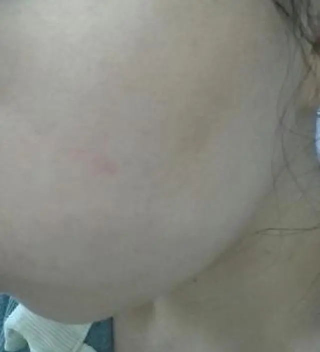 갈락토미 나이아신 에센스 50ml
